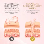 NovaMane™ Hair Regrowth 2.0 Adenosine & GHK-Cu Micro-Infusion System - Image 4