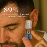 NovaMane™ Hair Regrowth 2.0 Adenosine & GHK-Cu Micro-Infusion System - Image 5